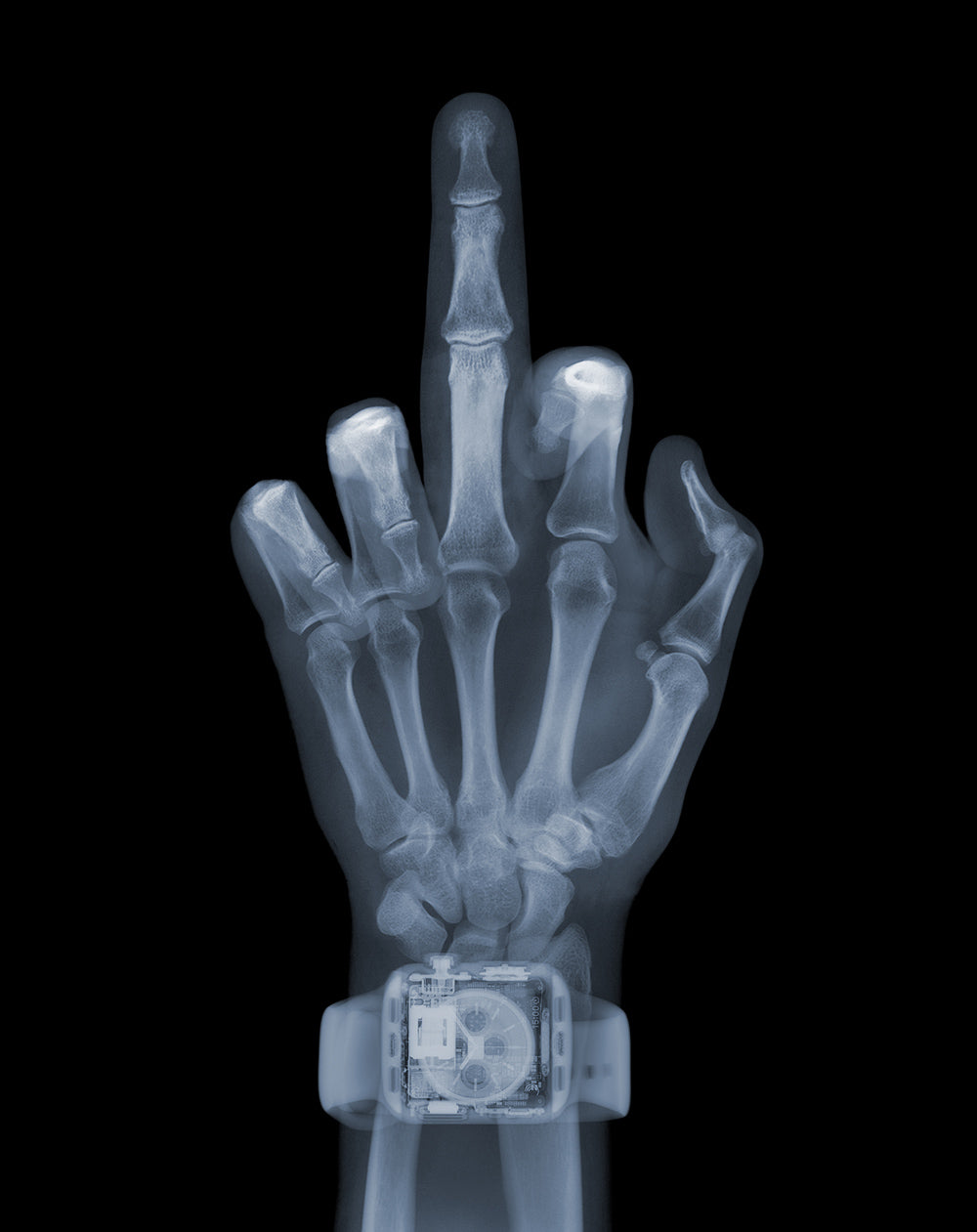 Finger with Watch, June 2019